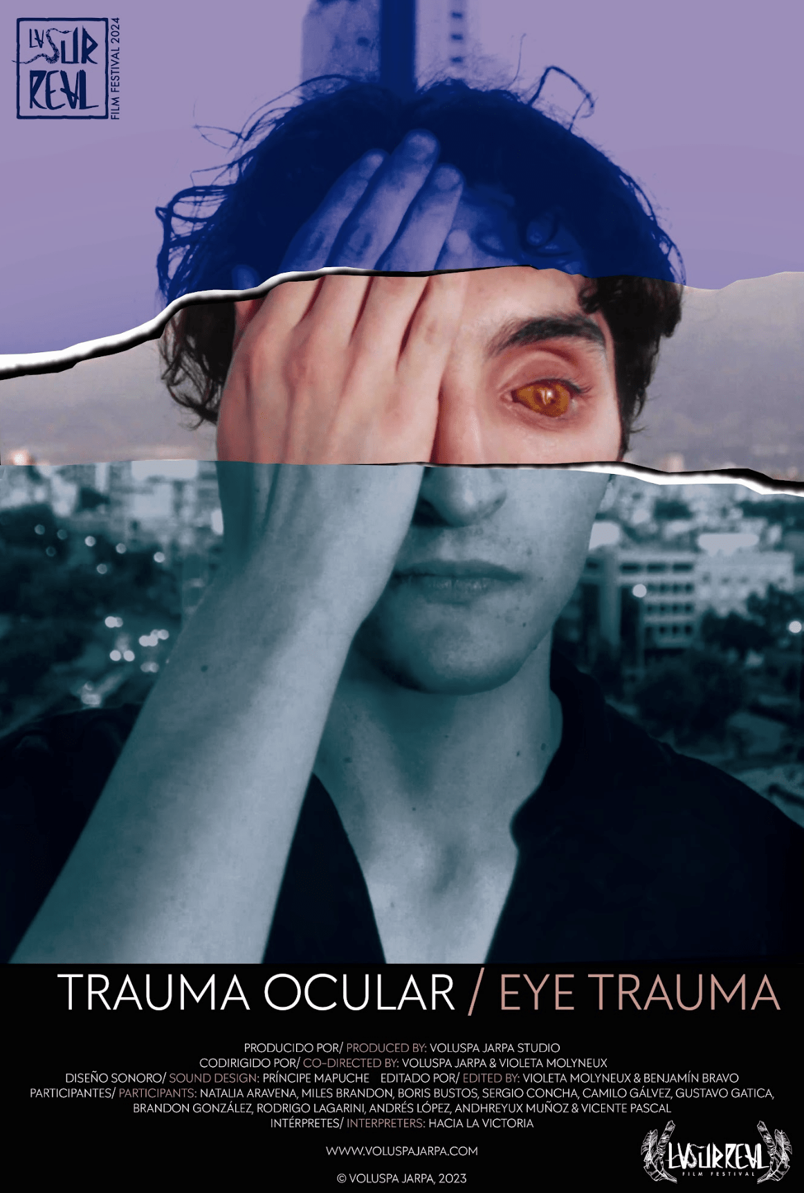 Trauma ocular_ Violeta Moulineux